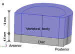 Effect of intervertebral disc degeneration on mechanical and electric signals at the interface between disc and vertebra
